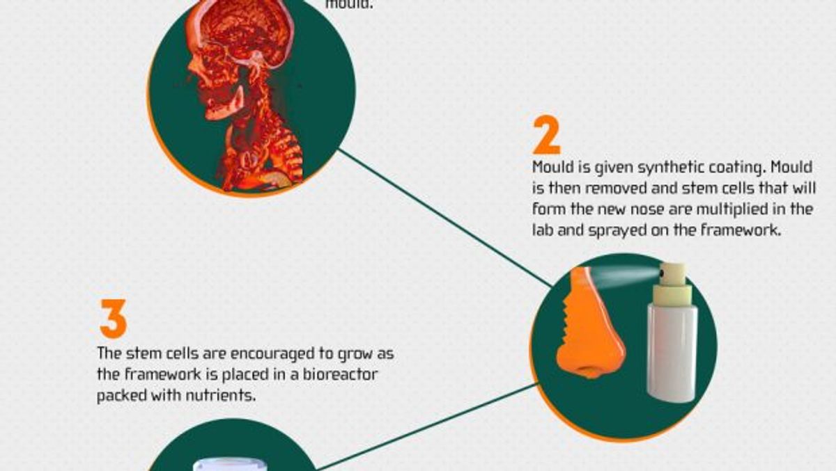 Personalized Medicine and Genomics